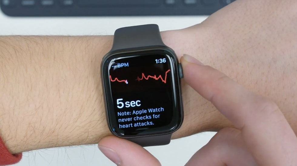 ECG trên Apple Watch