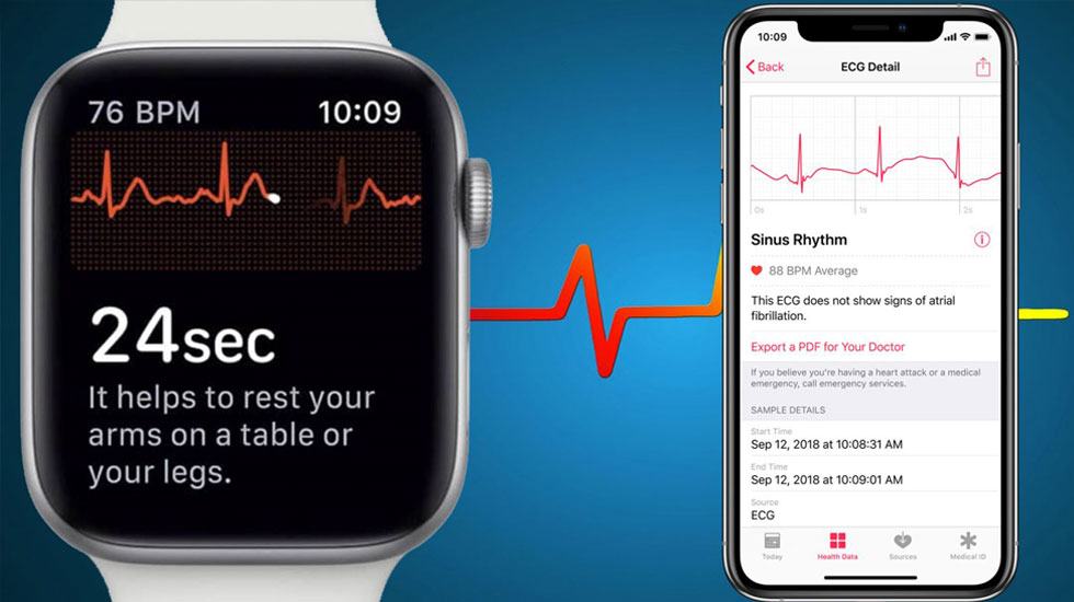 Cách dùng ECG trên Apple Watch ngoài nước Mỹ 2 báo cáo từ ứng dung ECG trên Apple Watch