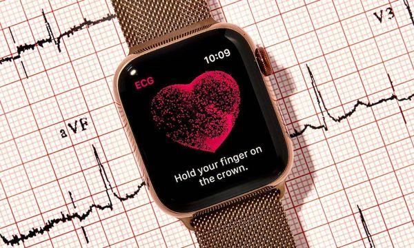 Apple Smartwatch ECG - Lý do các bác sĩ lo lắng về ECG của Apple Watch 1 Apple Smartwatch ECG - Lý do các bác sĩ tim mạch lo lắng về ECG của Apple Watch